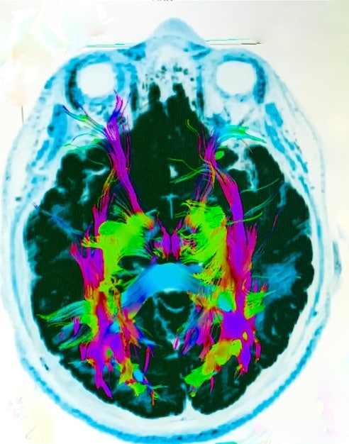 A brain scan illustration highlighting the areas associated with focus and concentration, with overlays of chemical structures of common supplement ingredients like caffeine, L-Theanine, and Bacopa Monnieri.