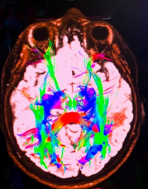 A brain scan visualization highlighting areas of the brain that become less active during multitasking, with labels indicating reduced cognitive function and increased mental fatigue.